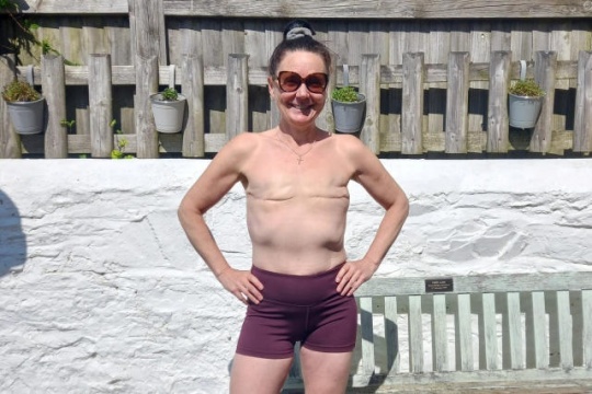 Superviviente de cáncer de mama corrió Maratón de Londres en topless para borrar estigma de mastectomía