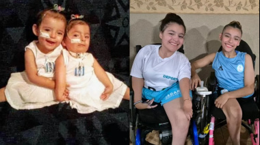 Nacieron siamesas y hoy son un ejemplo de superación en el deporte